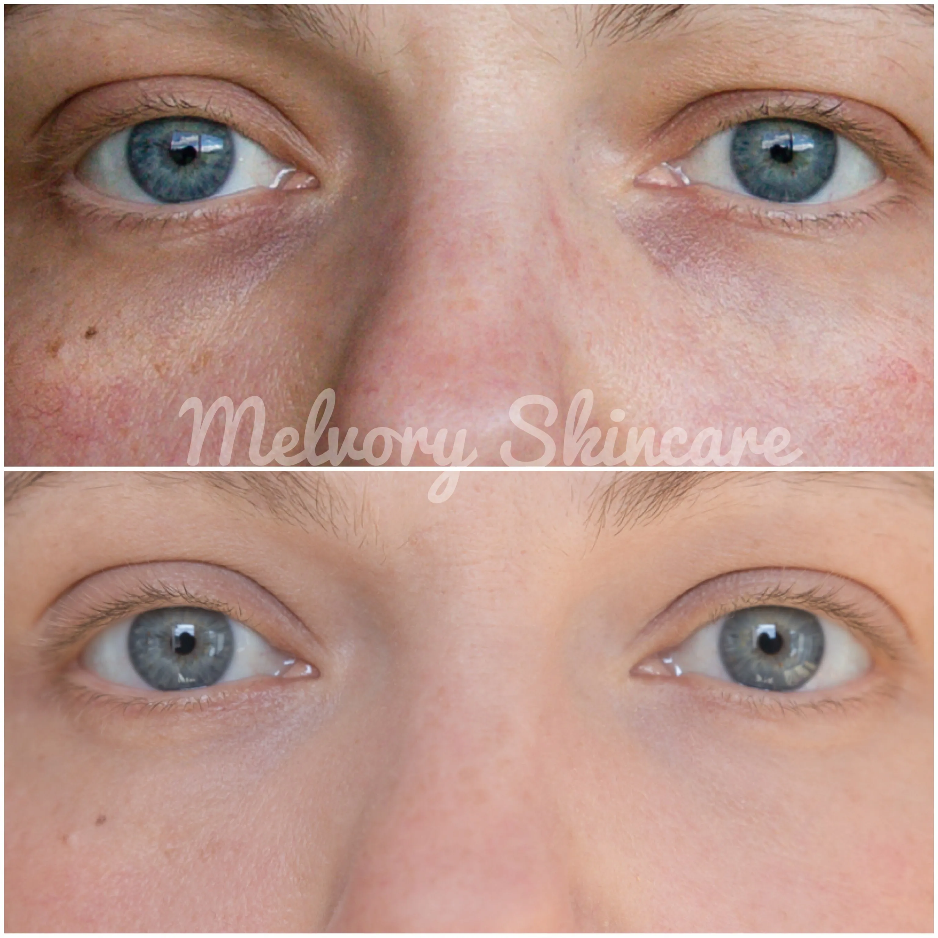 Goji Berry Eye Cream