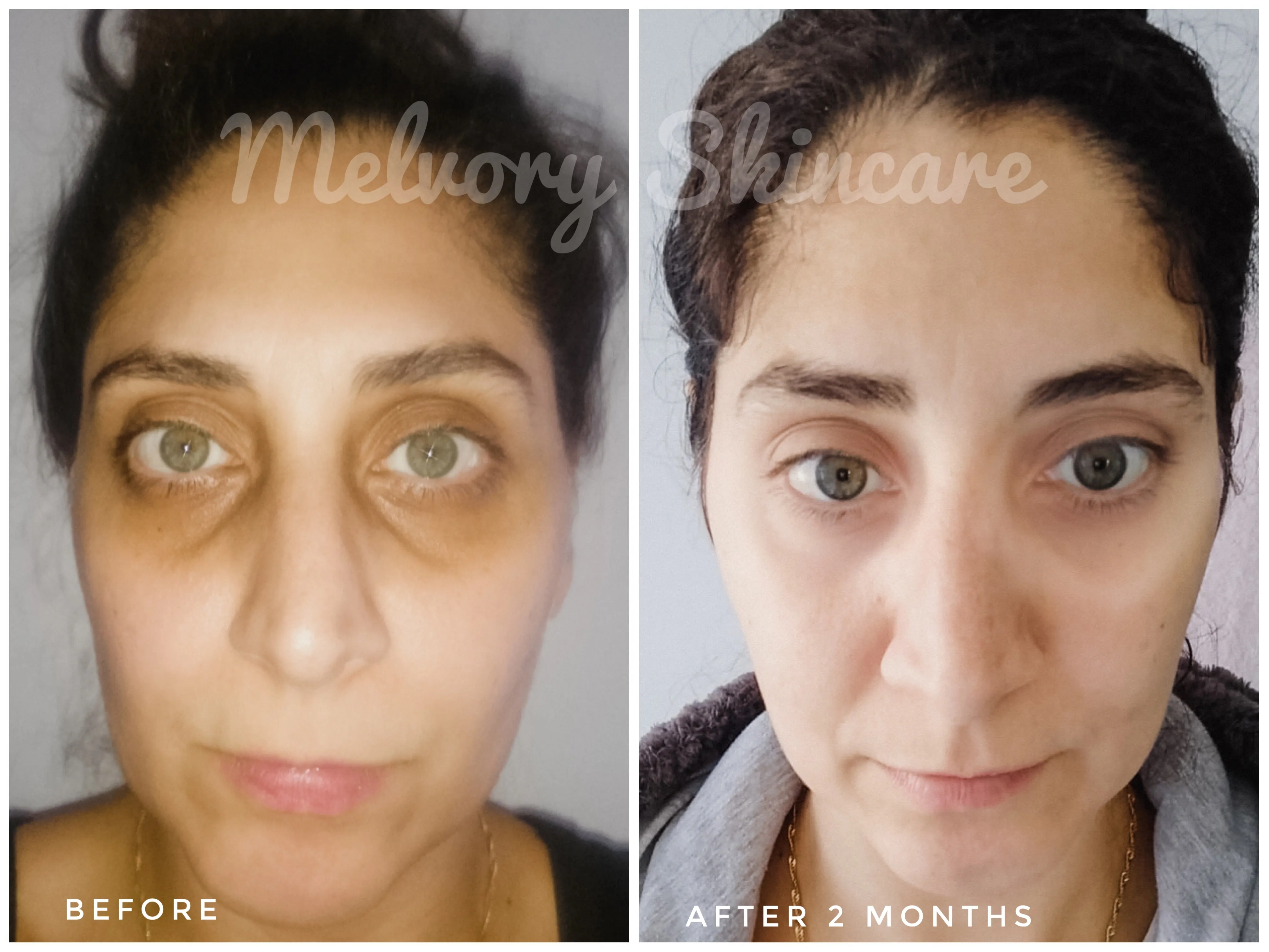 Goji Berry Eye Cream